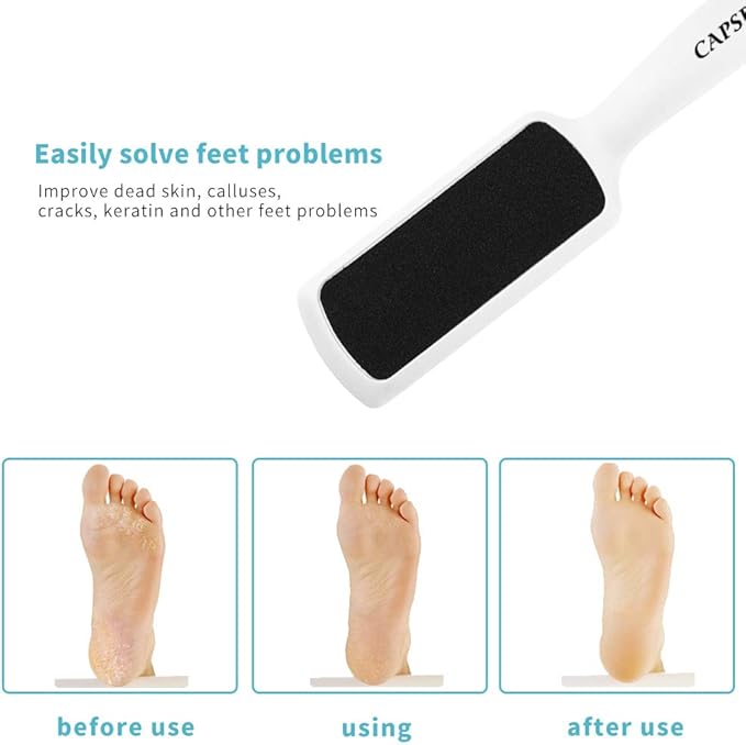 Pedicure Foot Rasp File Callus Remover, Double-Sided Colossal Foot Rasp Foot - Image 4