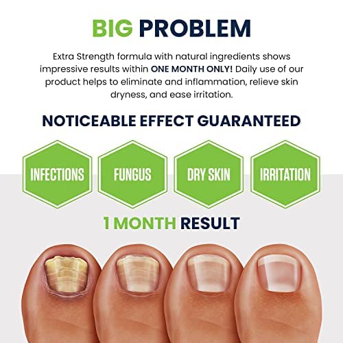 Toenail Fungus Treatment Extra Strength - Image 5