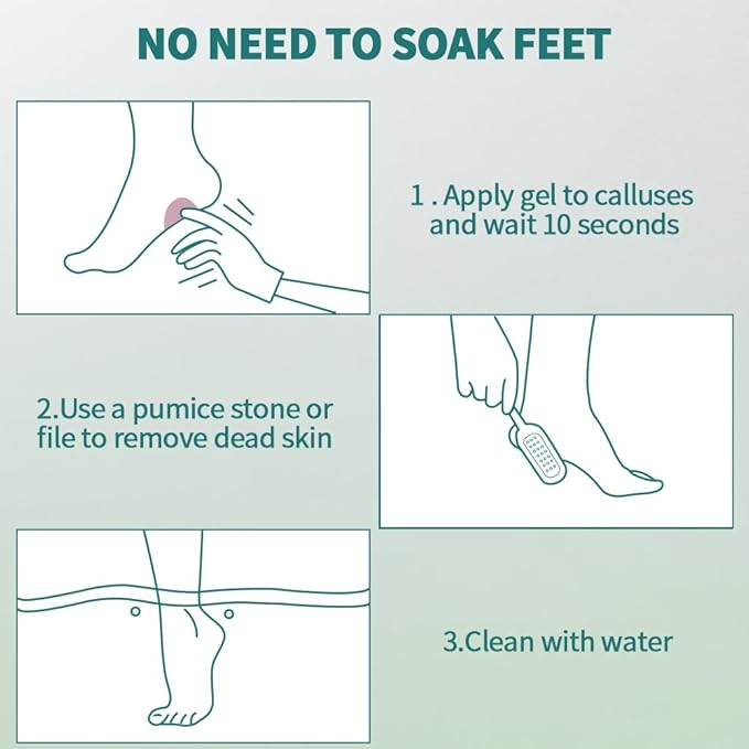 Gorgellux Callus Remover for Feet, Callus Remover Gel & Foot File Kit, Foot - Image 7