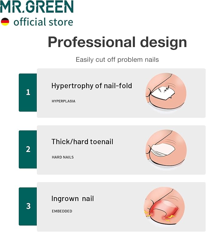 MR.GREEN Toenail Clippers Stainless Steel Ingrown Nail Cutter Thick and Hard - Image 2
