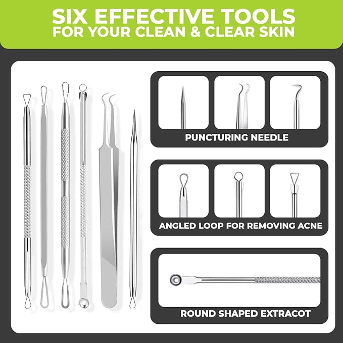 6 Pcs Blackhead Remover Tools 410 Grade Stainless Steel | Pimple Popper Tool - Image 4