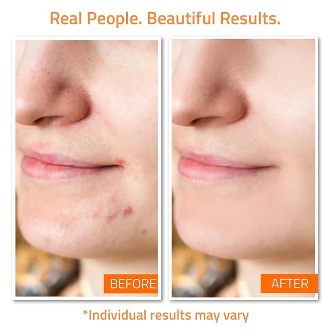 YEOUTH Skin Care Set: Vitamin C Face Wash, Vitamin C & Retinol Serum, Face Cream - Image 2