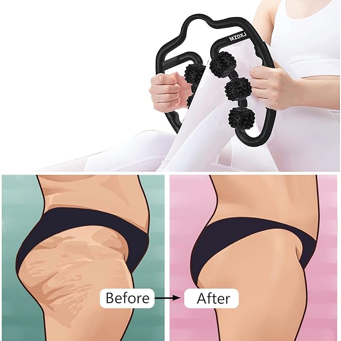 Cellulite Massage Tool Muscle Roller - Image 4