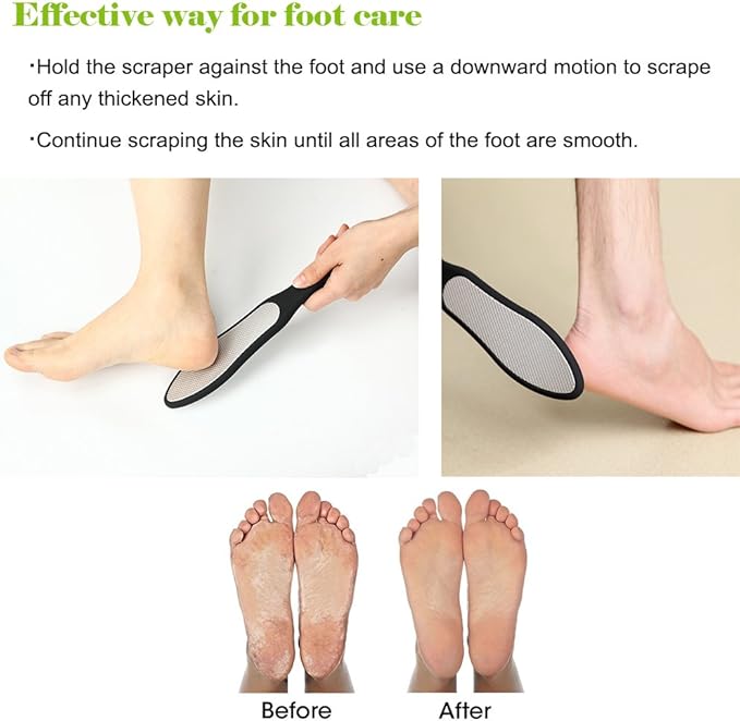 BEZOX Foot File, Double Sided Foot Scraper Callus Remover, Foot Rasp - Image 5