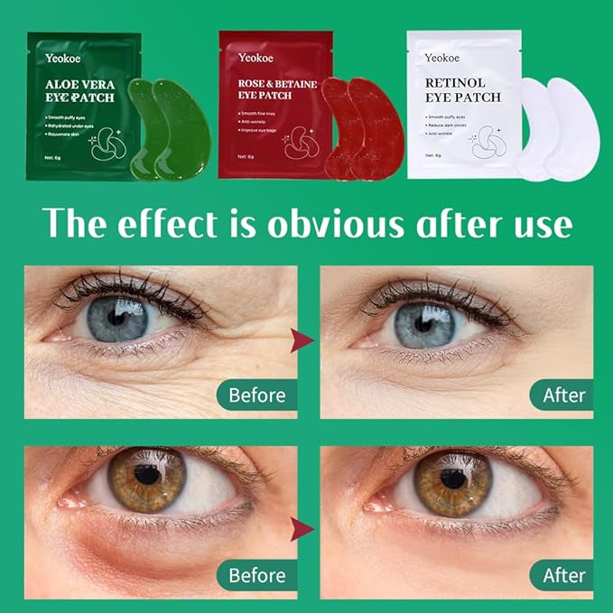 Yeokoe Under Eye Patches For Puffy Eyes and Dark Circles Wrinkle, 30 Pairs Face - Image 4