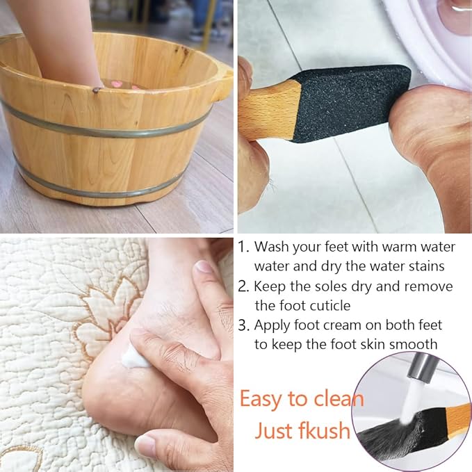 TOPMEET Foot File/Rasp, Exfoliator Pedicure Tool Foot Callus Remover Scrubber - Image 5