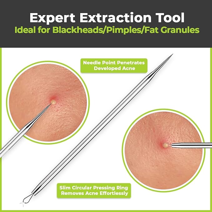 6 Pcs Blackhead Remover Tools 410 Grade Stainless Steel | Pimple Popper Tool - Image 3