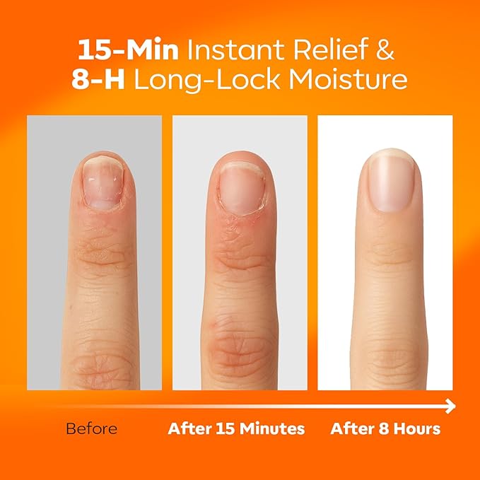 modelones Cuticle Oil Pen Rose for Growth and Strength Nail Growth Oil Cuticle - Image 2