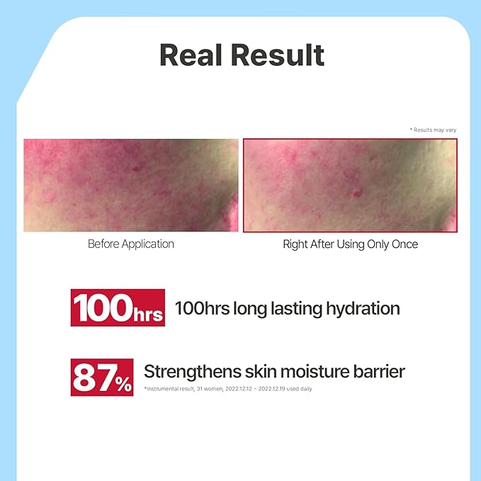 Illiyoon Ceramide Ato Lotion | Lightweight Moisturizer - Image 4