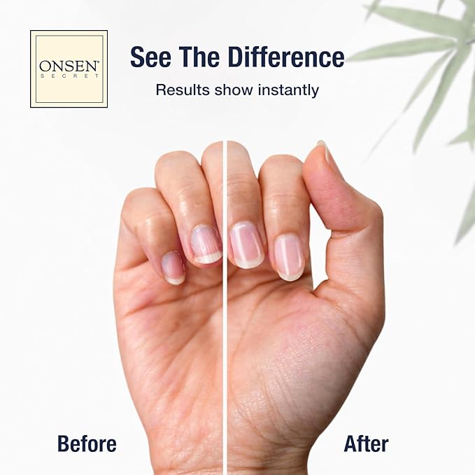 Onsen Secret Complete Nail Reboot Kit w/Cuticle Oil 10ml, Nail File 120/180 - Image 7