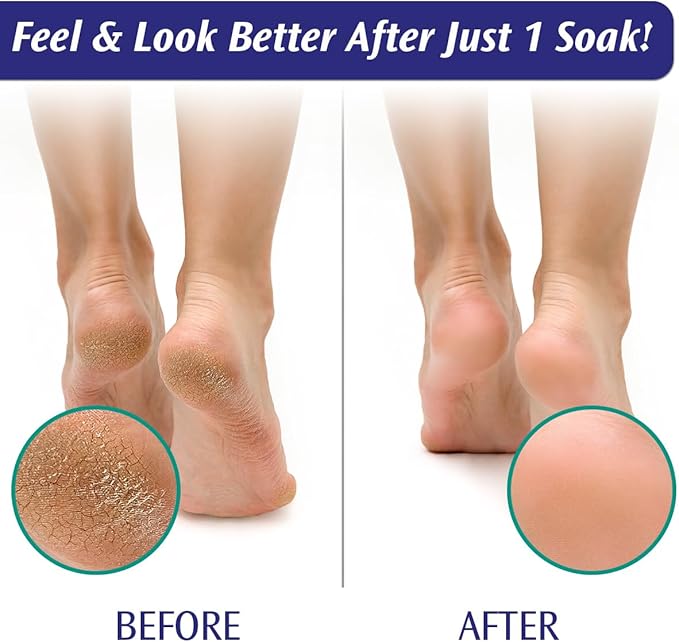 PediFix Soaking Crystals Foot Bath – 6 Packets – Therapeutic Foot Soak - Image 6