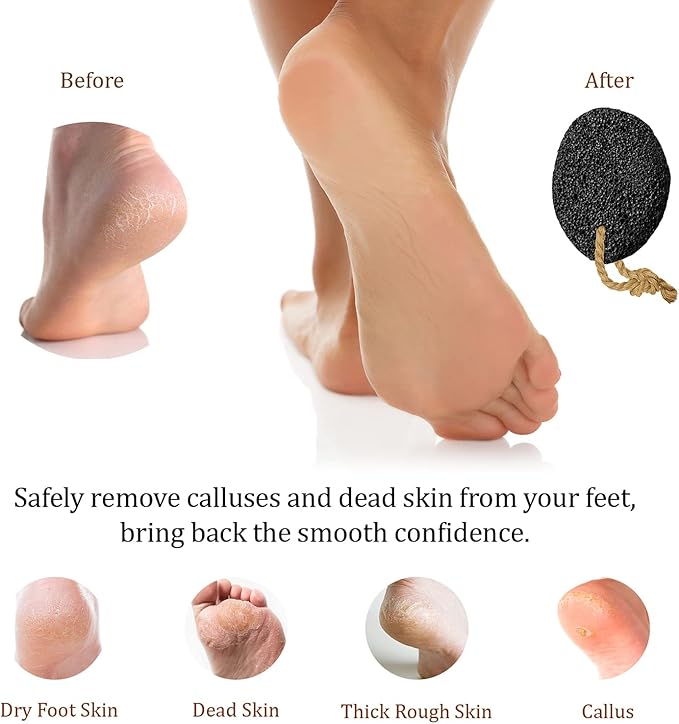 Pumice Stones for Feet - Image 4