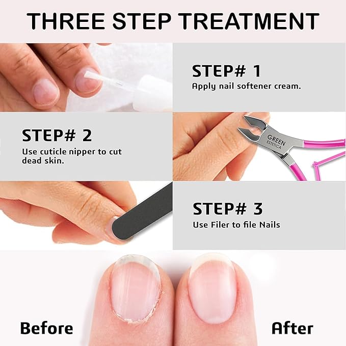 Professional Cuticle Trimmer Nail Cuticle Cutter Stainless Steel Cuticle Nippers - Image 6