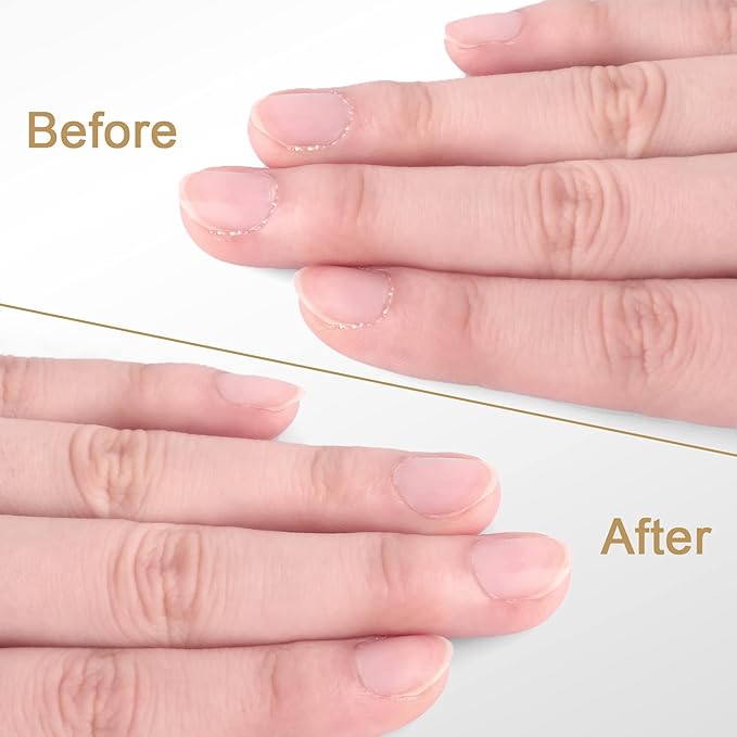 Easkep Cuticle Trimmer and Pusher, Professional Stainless Steel Cuticle Cutter - Image 6