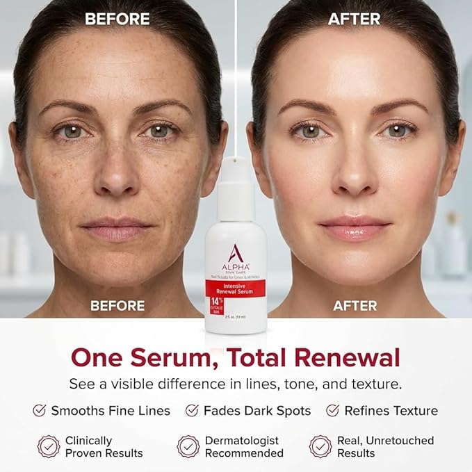 Alpha Skin Care Renewal Serum, 14% Glycolic AHA, Anti-Aging Formula, Alpha - Image 5