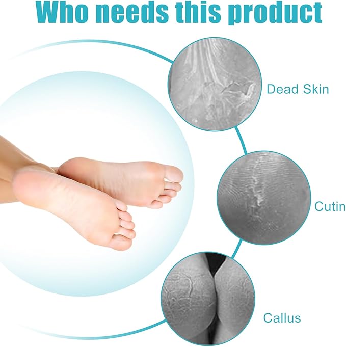 Foot File Callus Remover-3 Pcs 4 in 1 Foot Scrubber Dead Skin Remover - Image 7