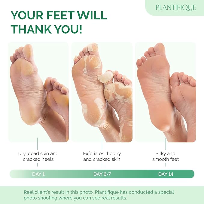 PLANTIFIQUE Foot Peeling Mask 1 Pack | Dermatologically Tested Repairs Heels & - Image 2