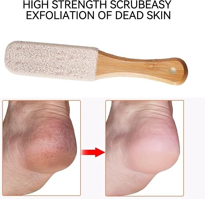 2-Pack Professional Pedicure Foot File - Image 3