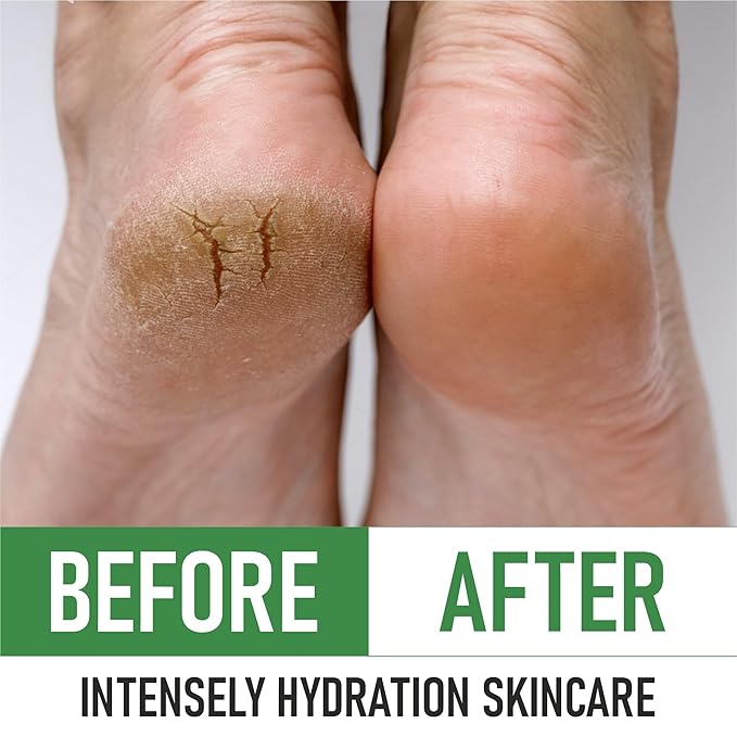 PurOrganica Urea Cream 40% – Made in USA, Maximum Strength Foot Cream - Image 5
