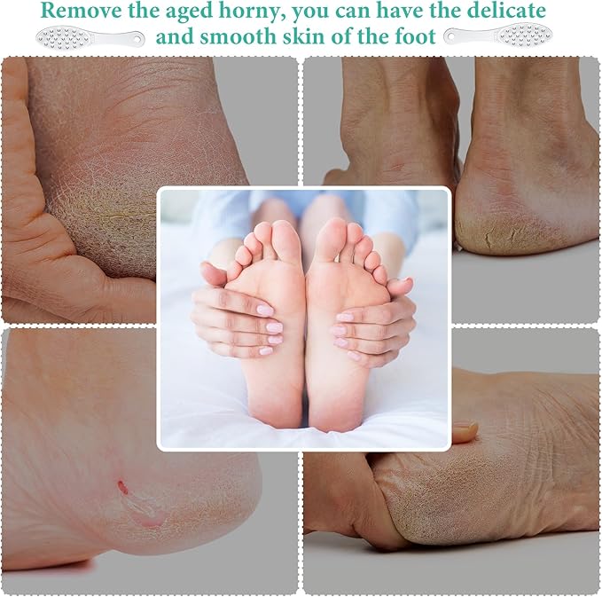 4 Pcs Stainless Steel Foot File Callus Remover Double Sided Metal Foot Rasp - Image 6