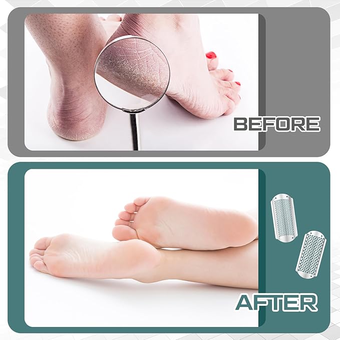 Moxweyeni 12 Pack Silver Foot File Callus Remover Replacement Blades Metal File - Image 5