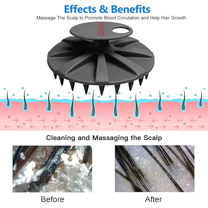 INNERNEED Scalp Care Massager Shampoo Brush, Wet & Dry Manual Head Scrubber - Image 4