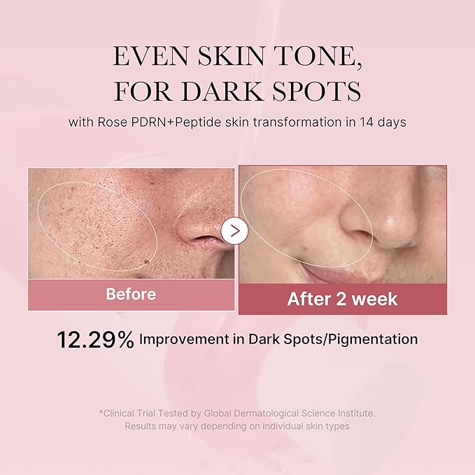 medicube PDRN Toner Rose PDRN Peptide Toner | Lightweight & Watery Type - Image 2