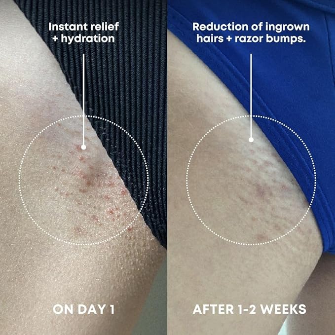 Bushbalm Ingrown Hair Exfoliating Scrub - Image 3