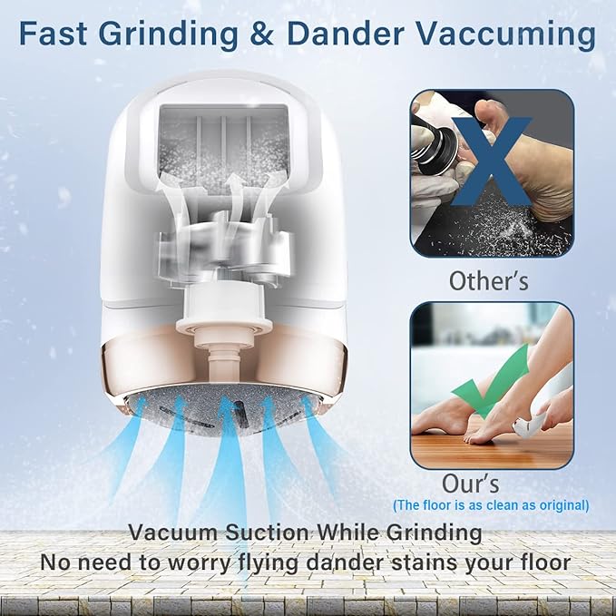 Hoxida Electric Callus Remover for Feet, Rechargeable Foot Pedicure Tools Foot - Image 4