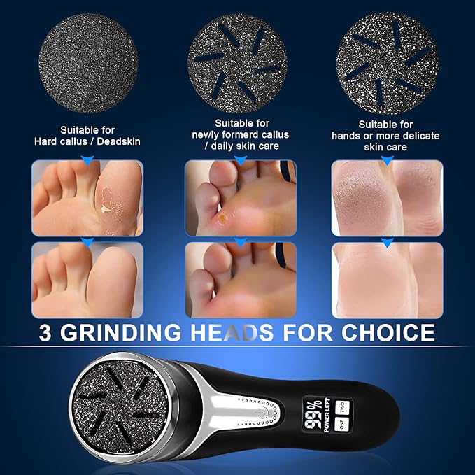 Electric Callus Remover for Feet - Image 6