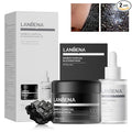 LANBENA 3-in-1 Blackhead Removal Set by LANBENA