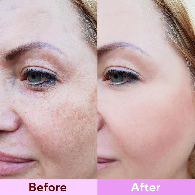 Collagen Face Mask, 4 Pack Bio-Collagen Real Deep Mask Overnight Hydrating Face - Image 7