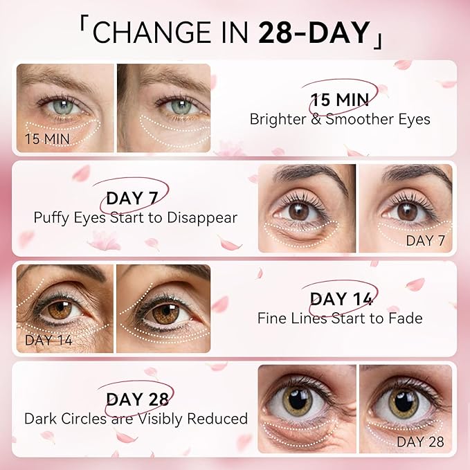 BREYLEE Flamingo Pink Eye Mask–60 Pcs-Puffy Eyes and Dark Circles - Image 6