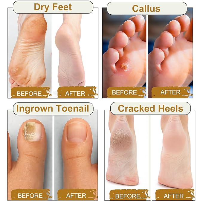 10Pack Foot Soak with Epsom Salt, Epsom Salts - Image 4