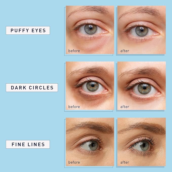 Enaskin Naturals Under Eye Patches - Image 7