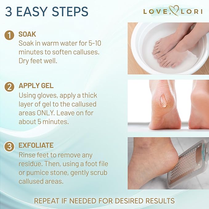 Foot Callus Remover Kit - Image 4