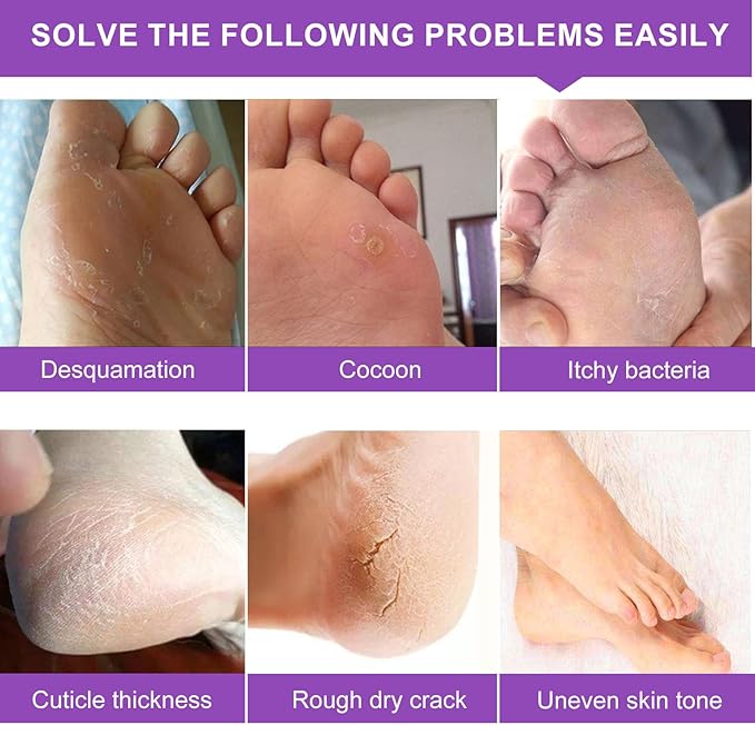 Foot Peeling Mask 5 Pack, Foot Peel Mask Remove Dead Skin, Rough Callus and - Image 4