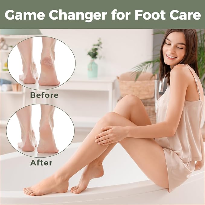 Foot File Foot Scrubber Pedicure - Image 7