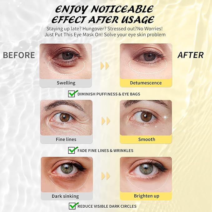 Maskiss Retinol Under Eye Patches, Puffy Eyes & Wrinkles, Firming Collagen Eye - Image 3