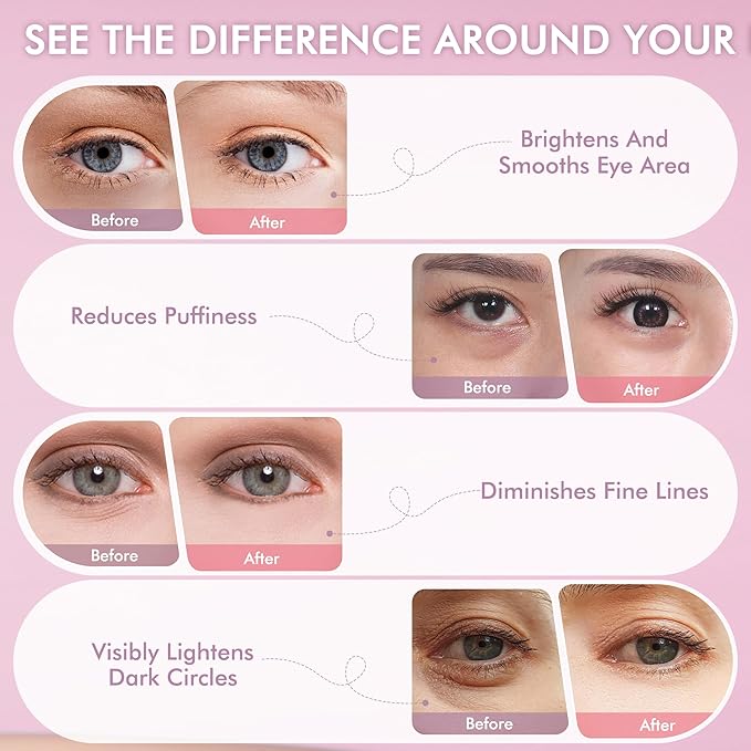 Under Eyes Patches, 40 Pairs Rose Hydrogel Eye Mask - Image 6