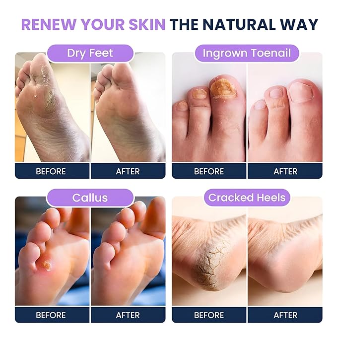 FOOT CURE Tea Tree Oil & Soothing Lavender Foot Soak - Image 5