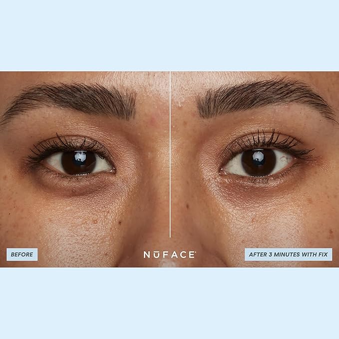 NuFACE IonPlex Hydra-Gel Power Under Eye Patches - Image 5