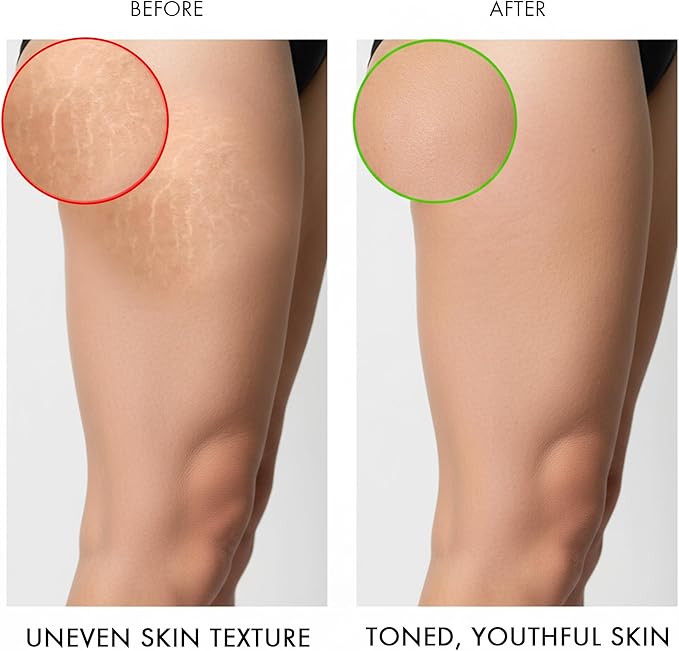 Majestic Pure Cellulite Massage Oil - Image 6