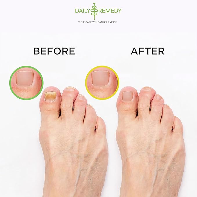 DAILY REMEDY 4-Pack Foot Soak Set - Image 6