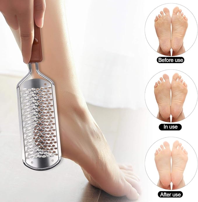 2 Pieces Colossal Foot Rasp Foot Files Callus Remover Foot Scrubber, Stainless - Image 4