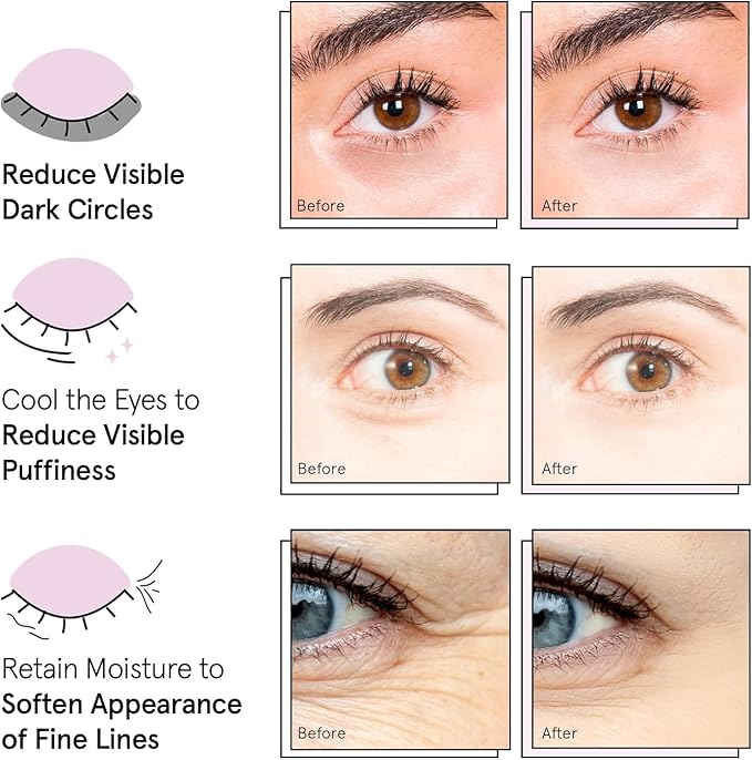 grace & stella Award Winning Under Eye Mask - Image 8