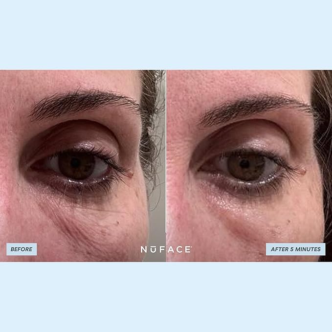 NuFACE IonPlex Hydra-Gel Power Under Eye Patches - Image 6