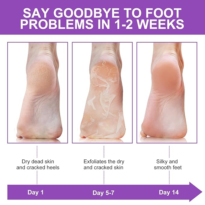 ALIVER Foot Peel Mask 3 Pack, Exfoliator Peel Off Calluses Dead Skin Callus - Image 7