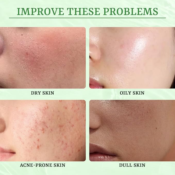 Anti Acne Face Mask Salicylic Acid Face Masks Skincare, Hydrating Face Masks - Image 5