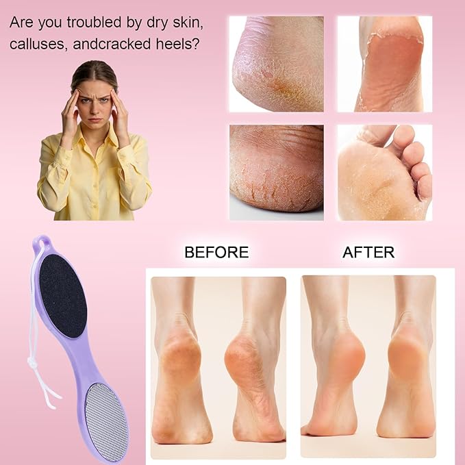 4-in-1 Nano Glass Foot Callus Remover, Professional Foot File, Durable Foot - Image 5